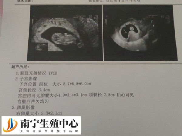 怀孕45天的时候属于孕早期