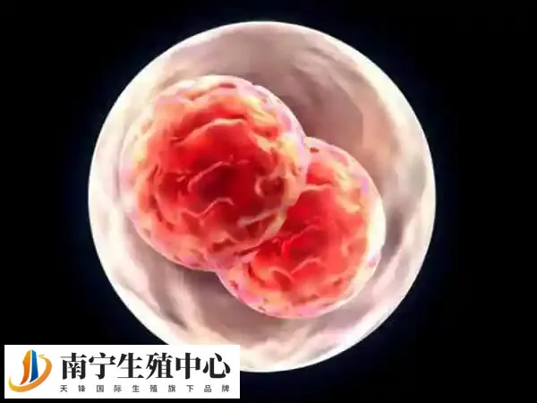 导致移植后尿频的原因有很多